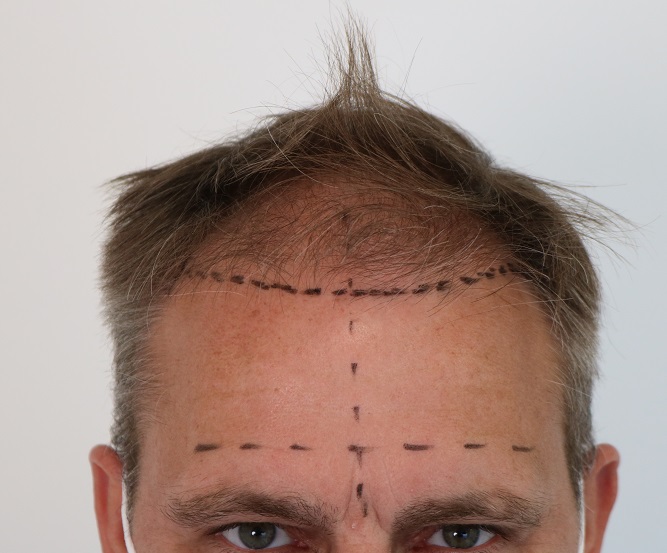 /foren/transplant/index.php/fa/52125/0/