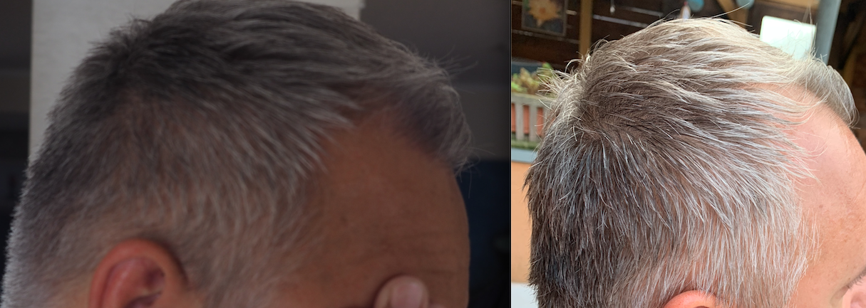 /foren/transplant/index.php/fa/52127/0/