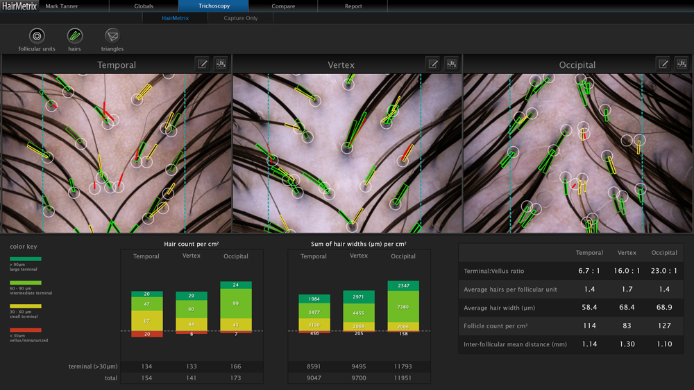 /foren/transplant/index.php/fa/52156/0/