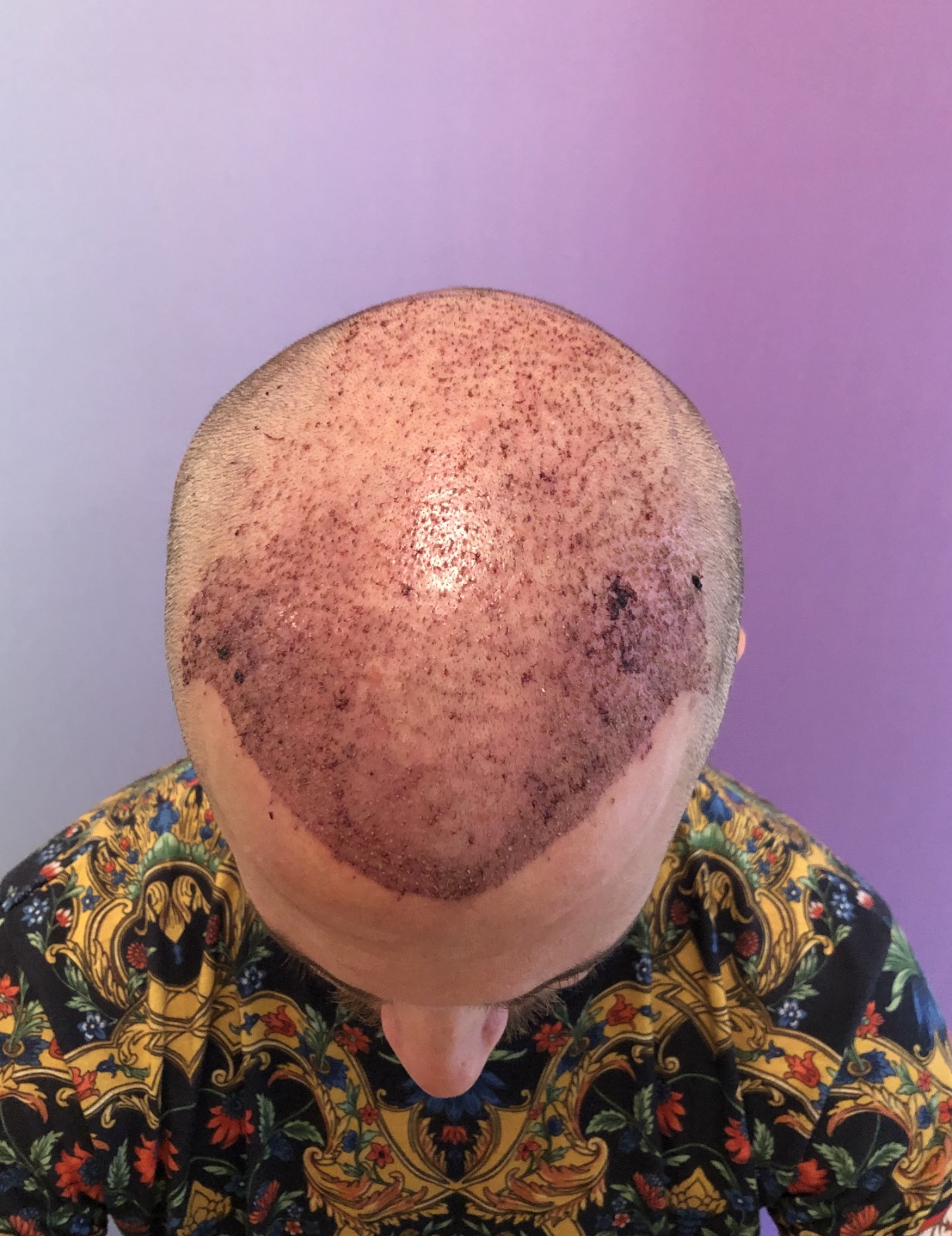 /foren/transplant/index.php/fa/52212/0/