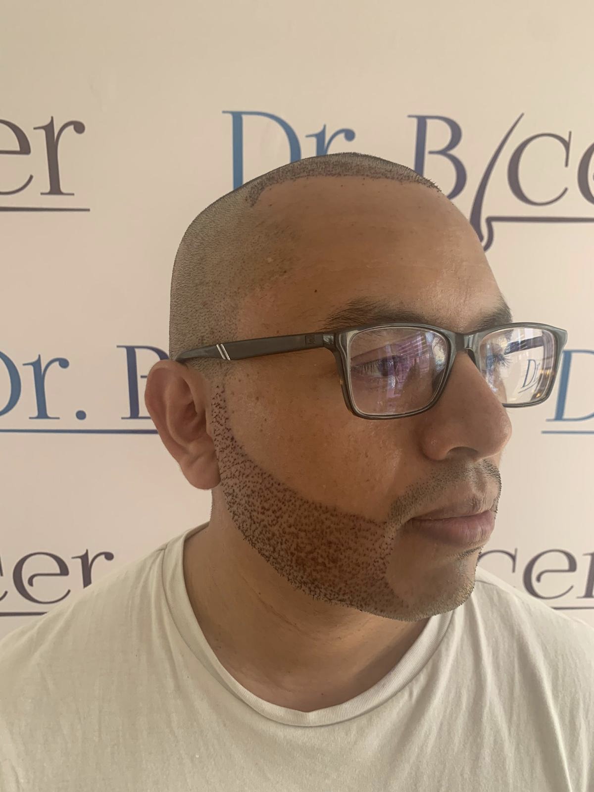 /foren/transplant/index.php/fa/52260/0/