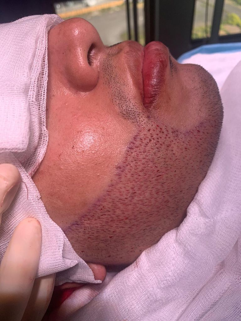 /foren/transplant/index.php/fa/52262/0/