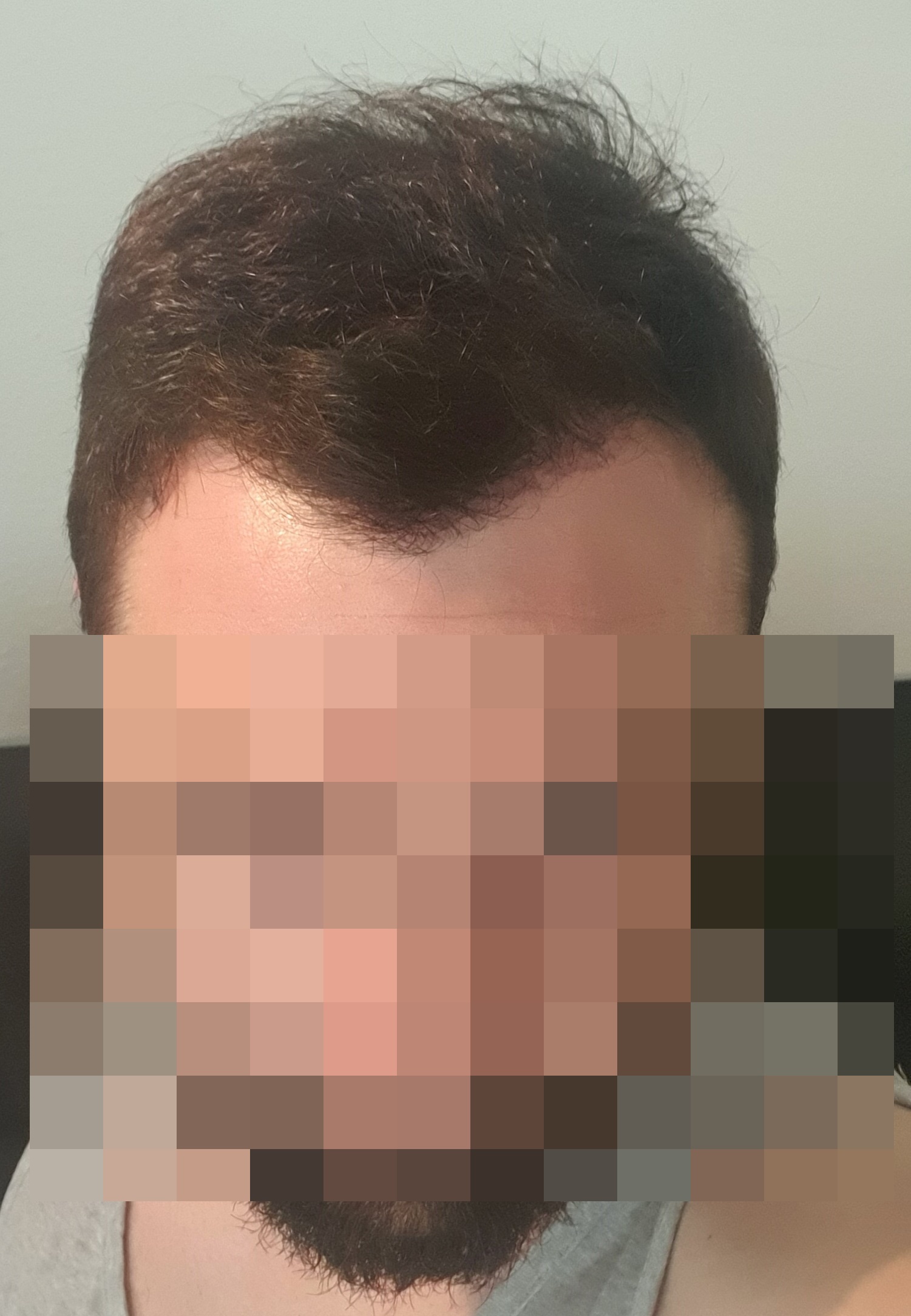 /foren/transplant/index.php/fa/52263/0/