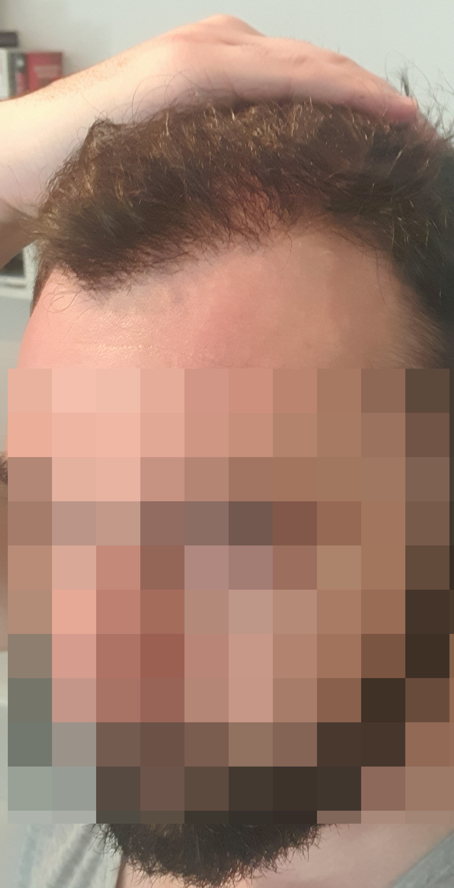 /foren/transplant/index.php/fa/52264/0/