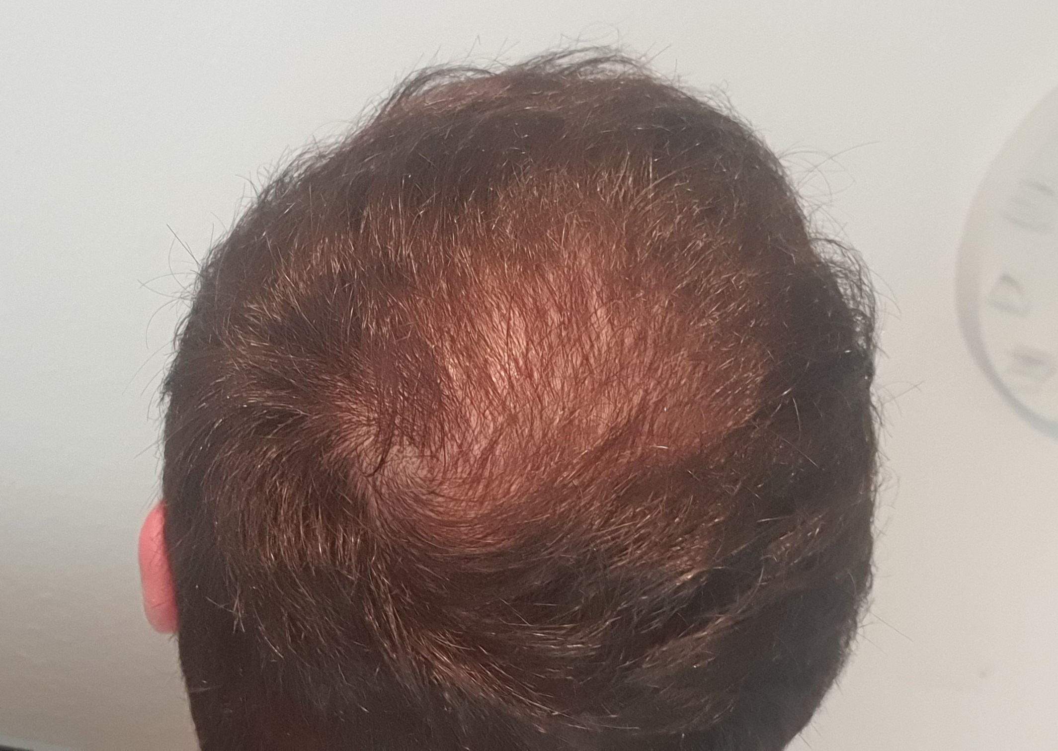 /foren/transplant/index.php/fa/52265/0/