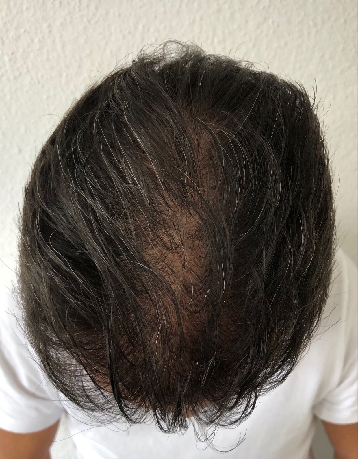 /foren/transplant/index.php/fa/52269/0/