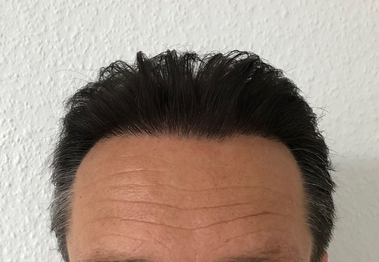 /foren/transplant/index.php/fa/52270/0/