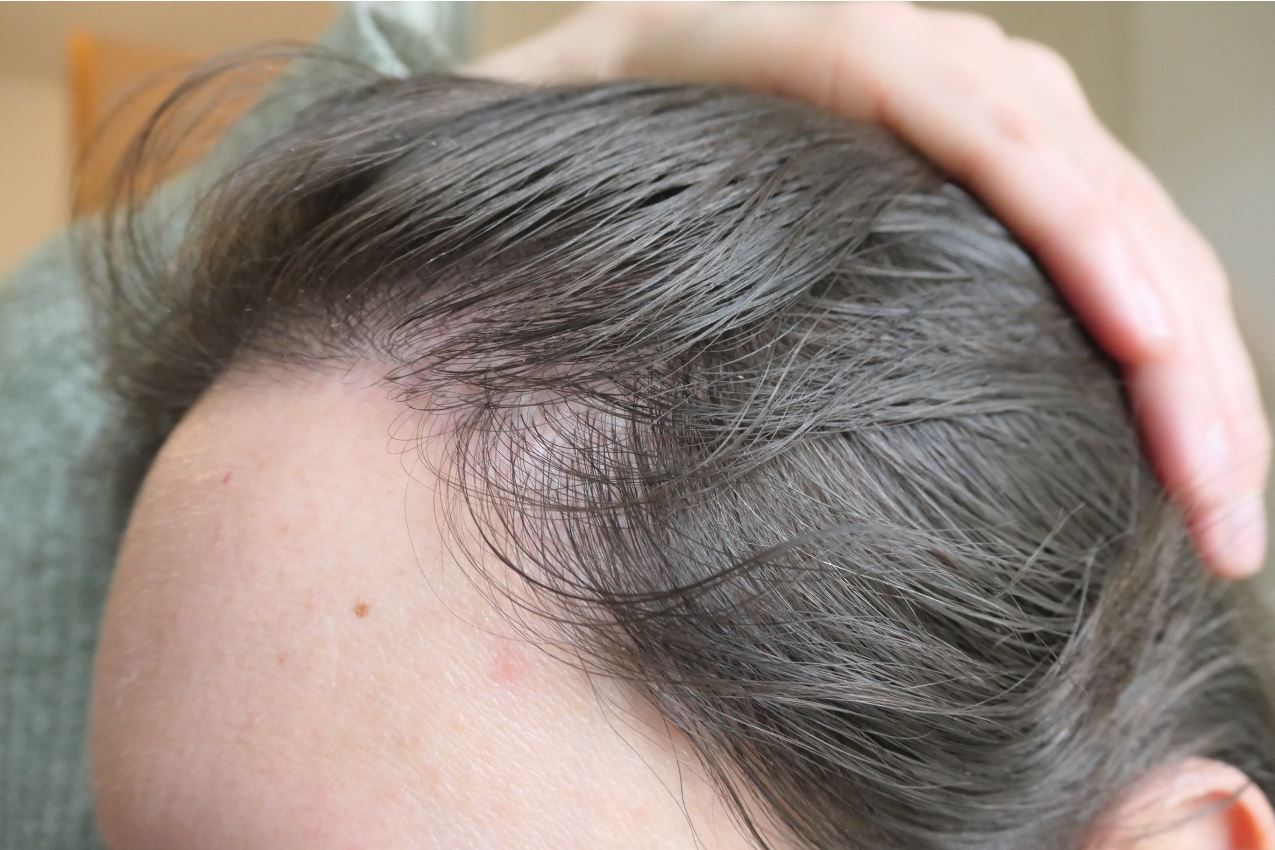 /foren/transplant/index.php/fa/52275/0/