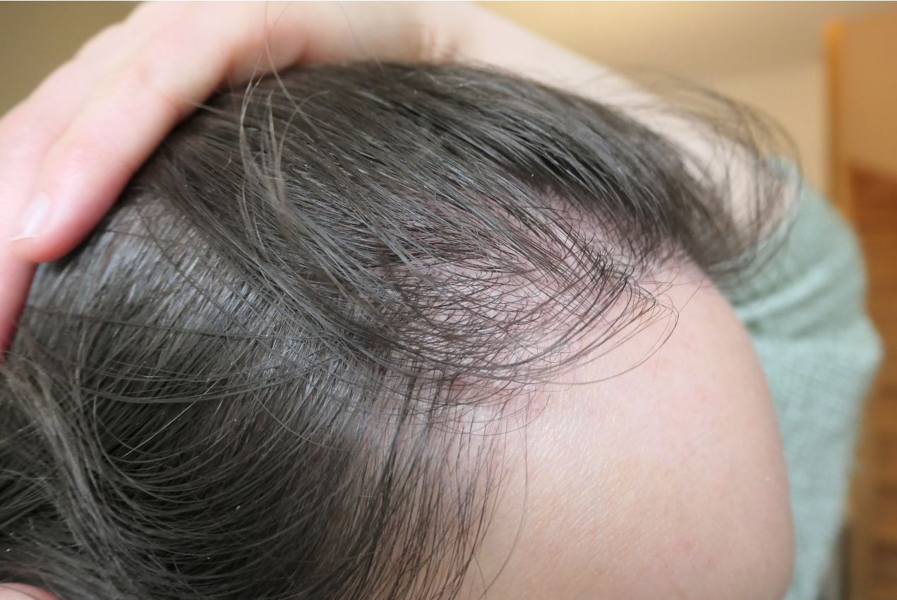 /foren/transplant/index.php/fa/52276/0/