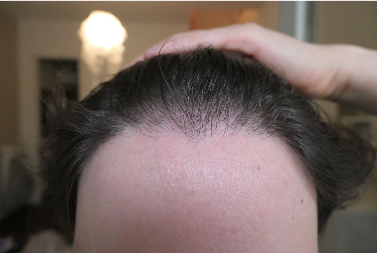 /foren/transplant/index.php/fa/52277/0/