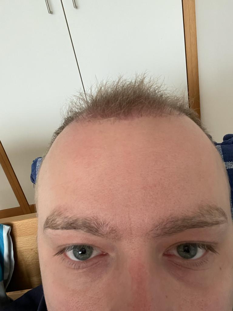 /foren/transplant/index.php/fa/52336/0/