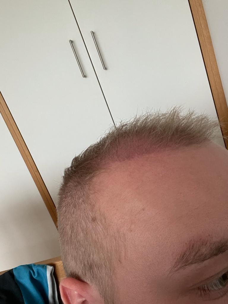 /foren/transplant/index.php/fa/52337/0/