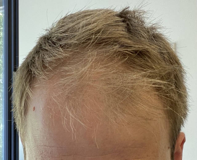 /foren/transplant/index.php/fa/52357/0/