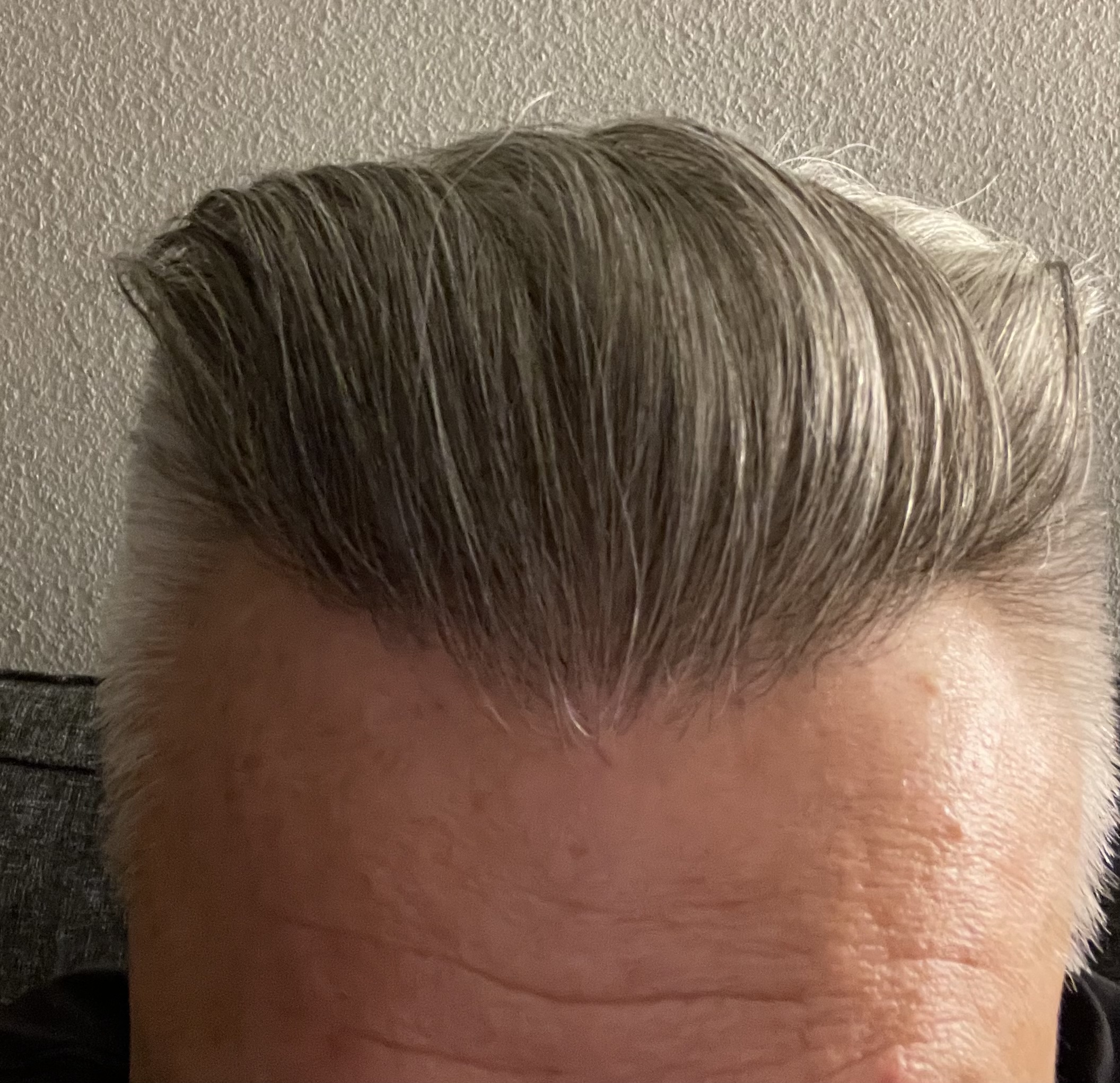 /foren/transplant/index.php/fa/52379/0/