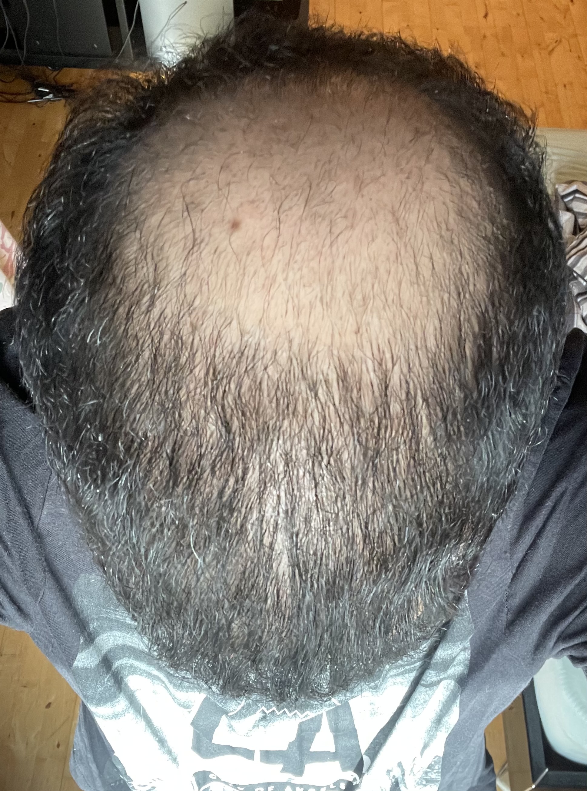 /foren/transplant/index.php/fa/52395/0/