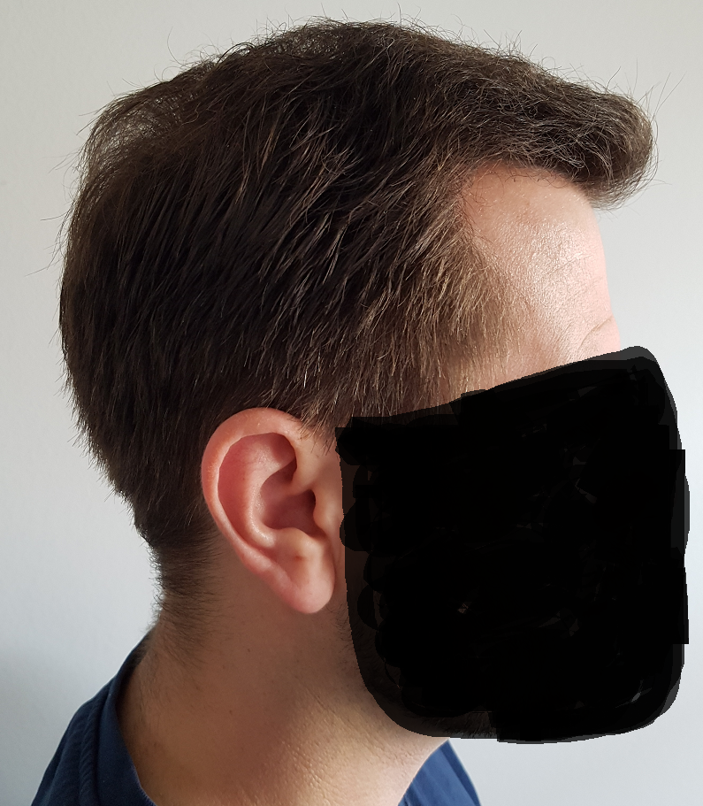 /foren/transplant/index.php/fa/52424/0/