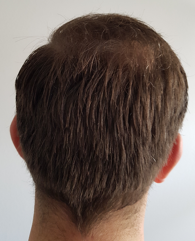 /foren/transplant/index.php/fa/52425/0/