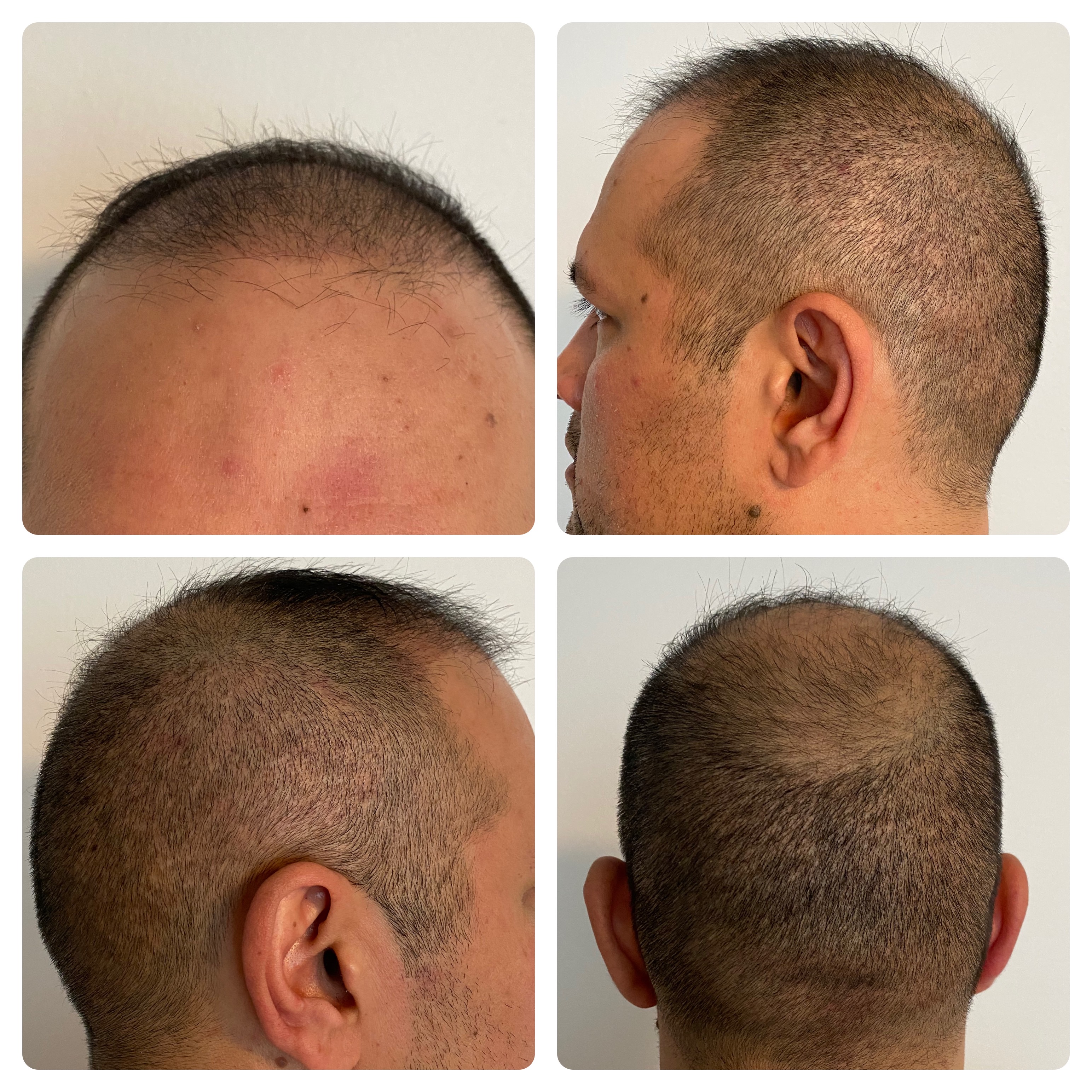 /foren/transplant/index.php/fa/52475/0/