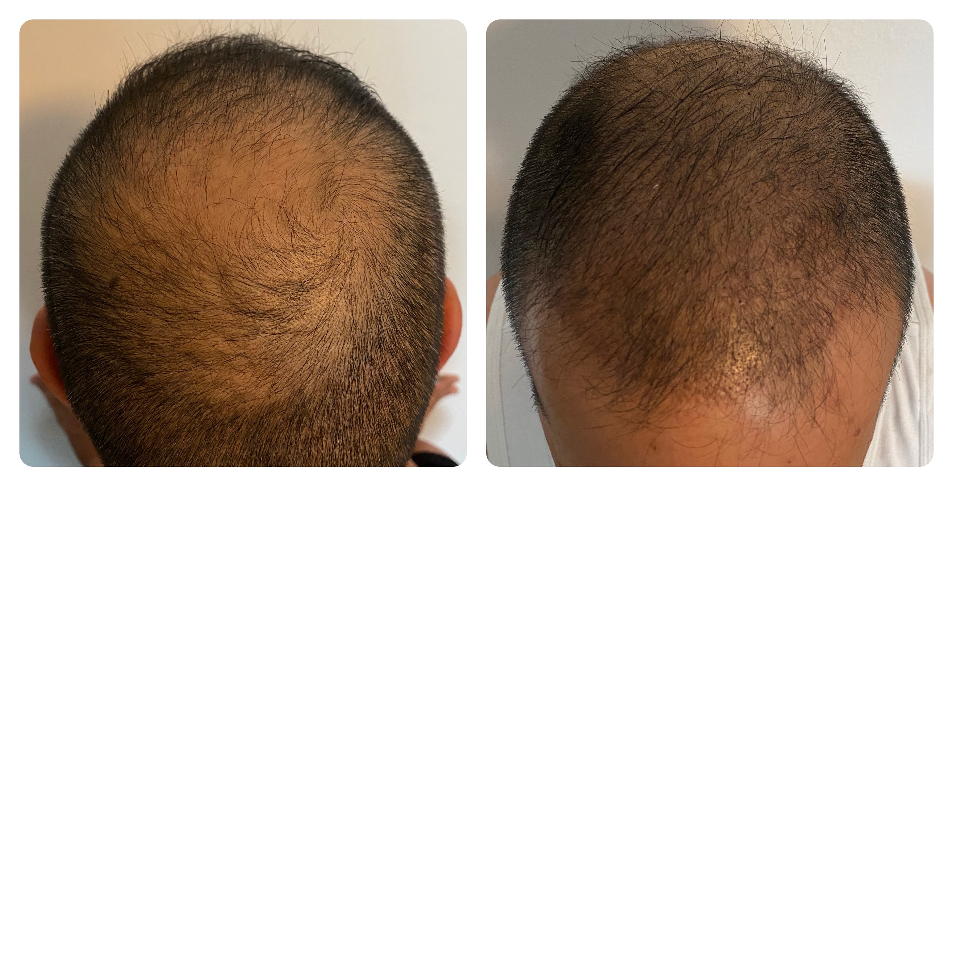 /foren/transplant/index.php/fa/52476/0/