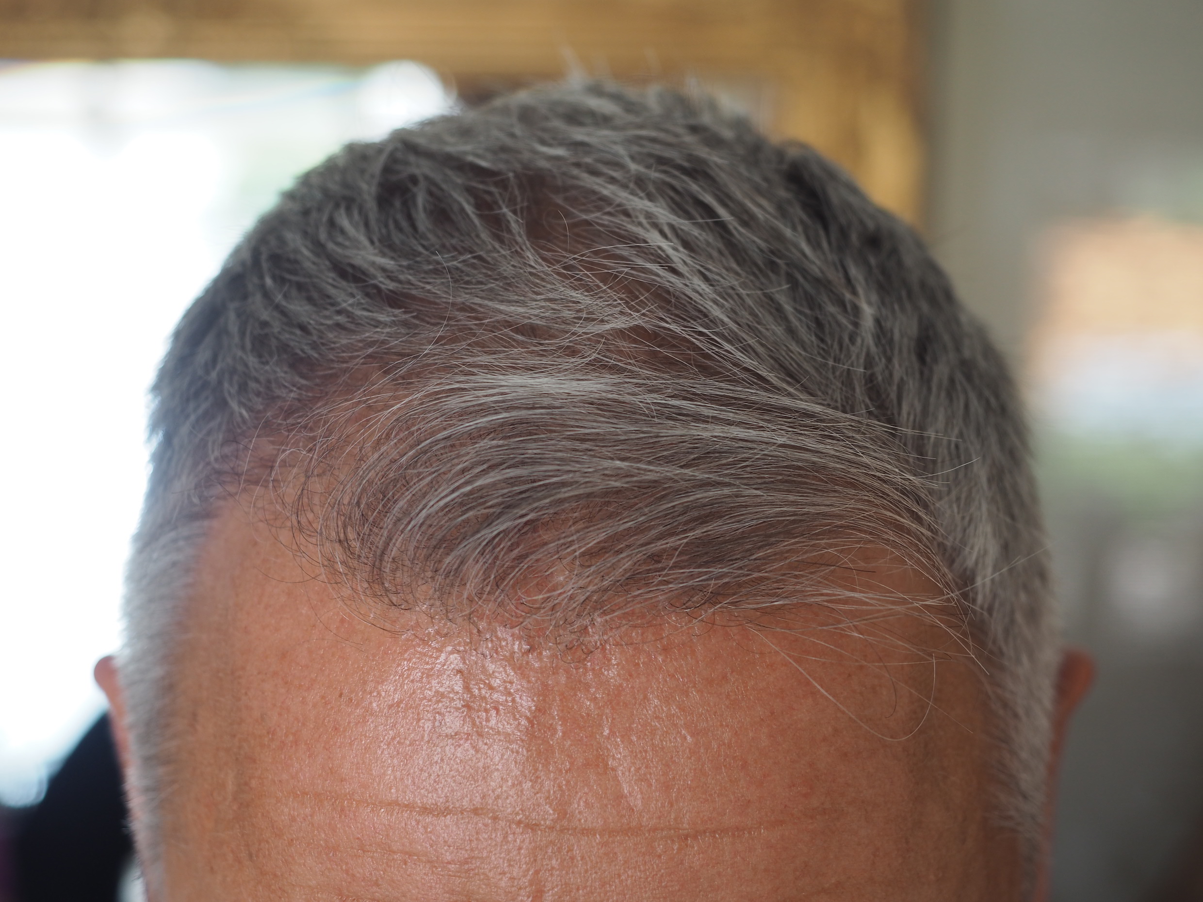 /foren/transplant/index.php/fa/52477/0/