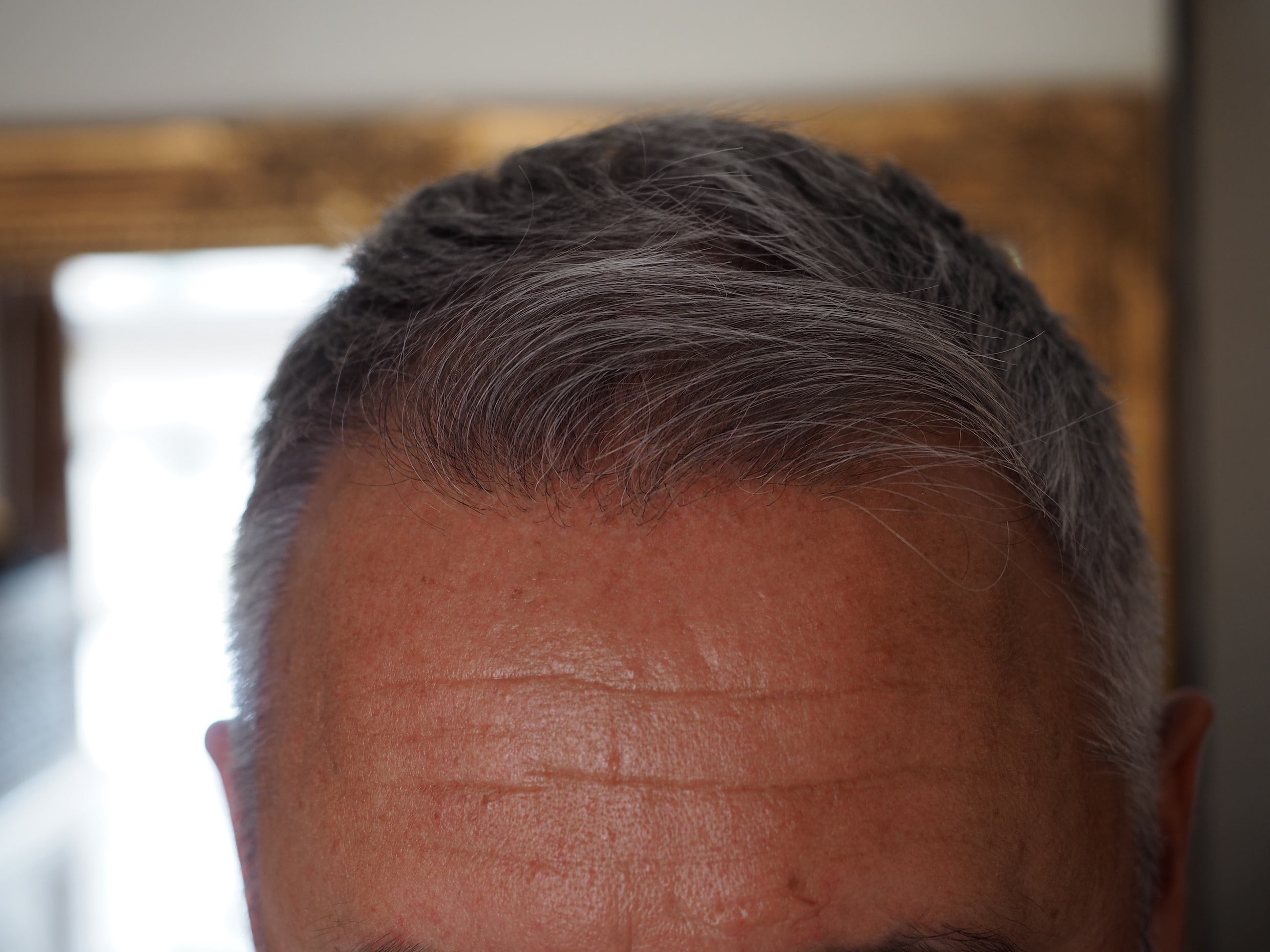 /foren/transplant/index.php/fa/52478/0/