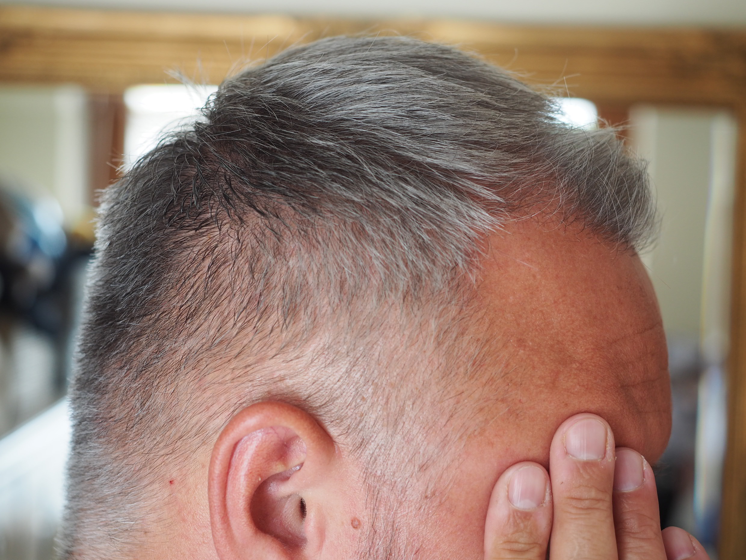 /foren/transplant/index.php/fa/52479/0/