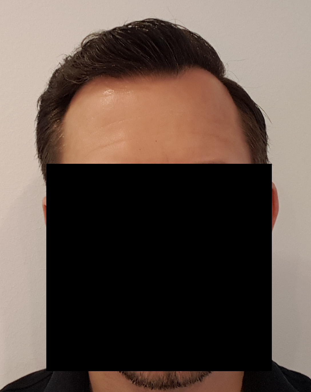 /foren/transplant/index.php/fa/52515/0/