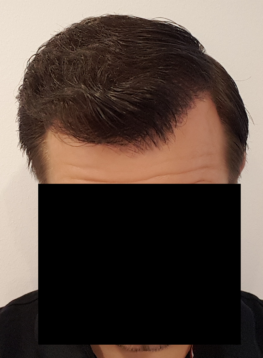 /foren/transplant/index.php/fa/52516/0/