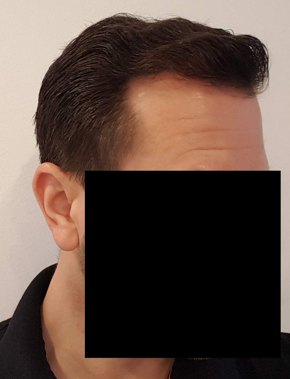 /foren/transplant/index.php/fa/52517/0/