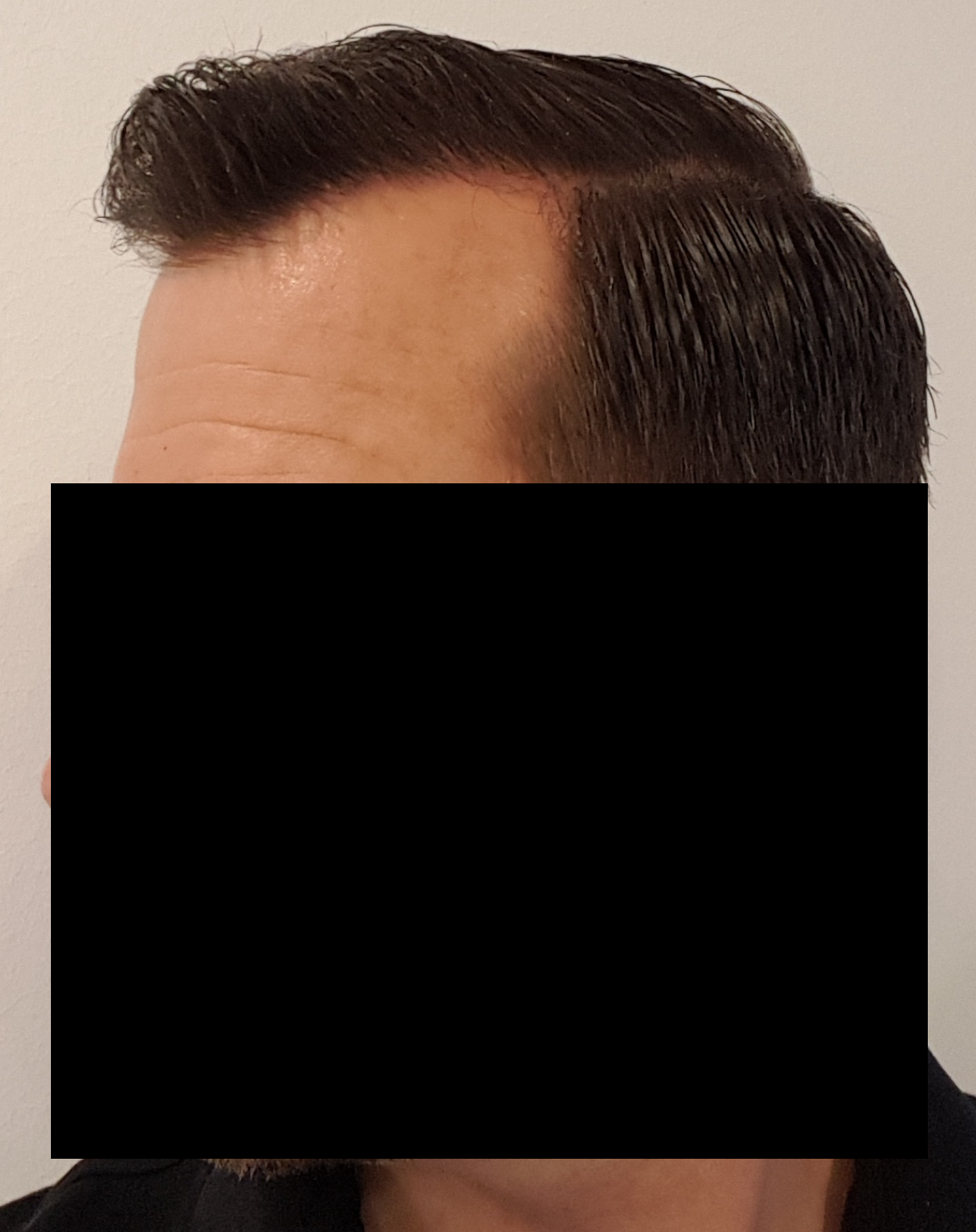 /foren/transplant/index.php/fa/52518/0/