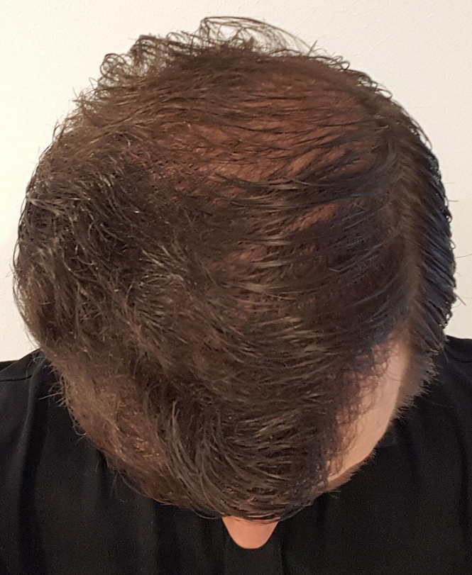 /foren/transplant/index.php/fa/52519/0/