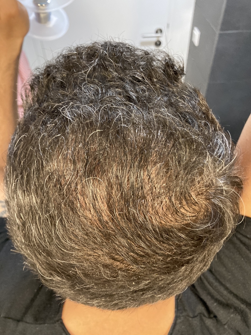 /foren/transplant/index.php/fa/52533/0/