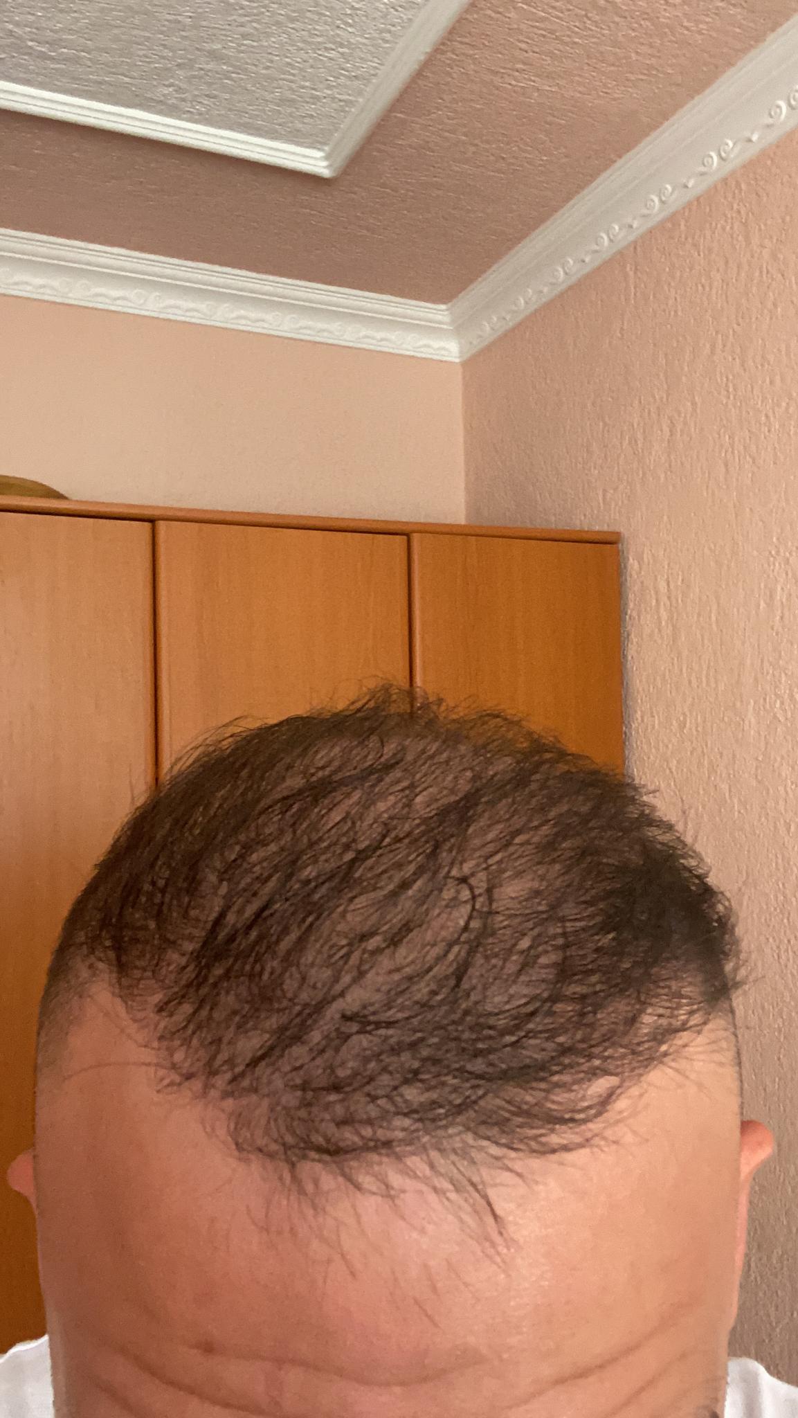 /foren/transplant/index.php/fa/52544/0/