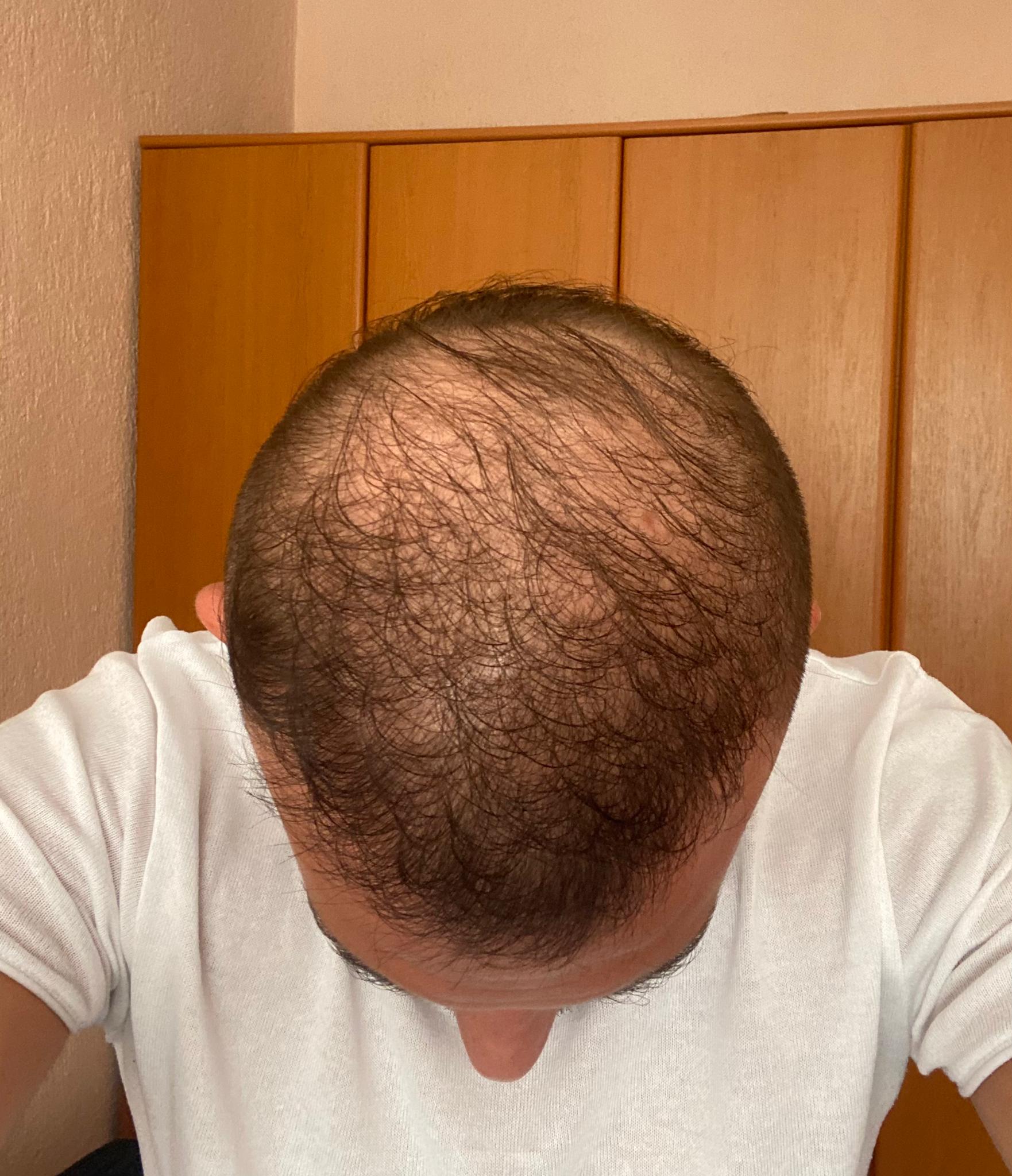 /foren/transplant/index.php/fa/52546/0/