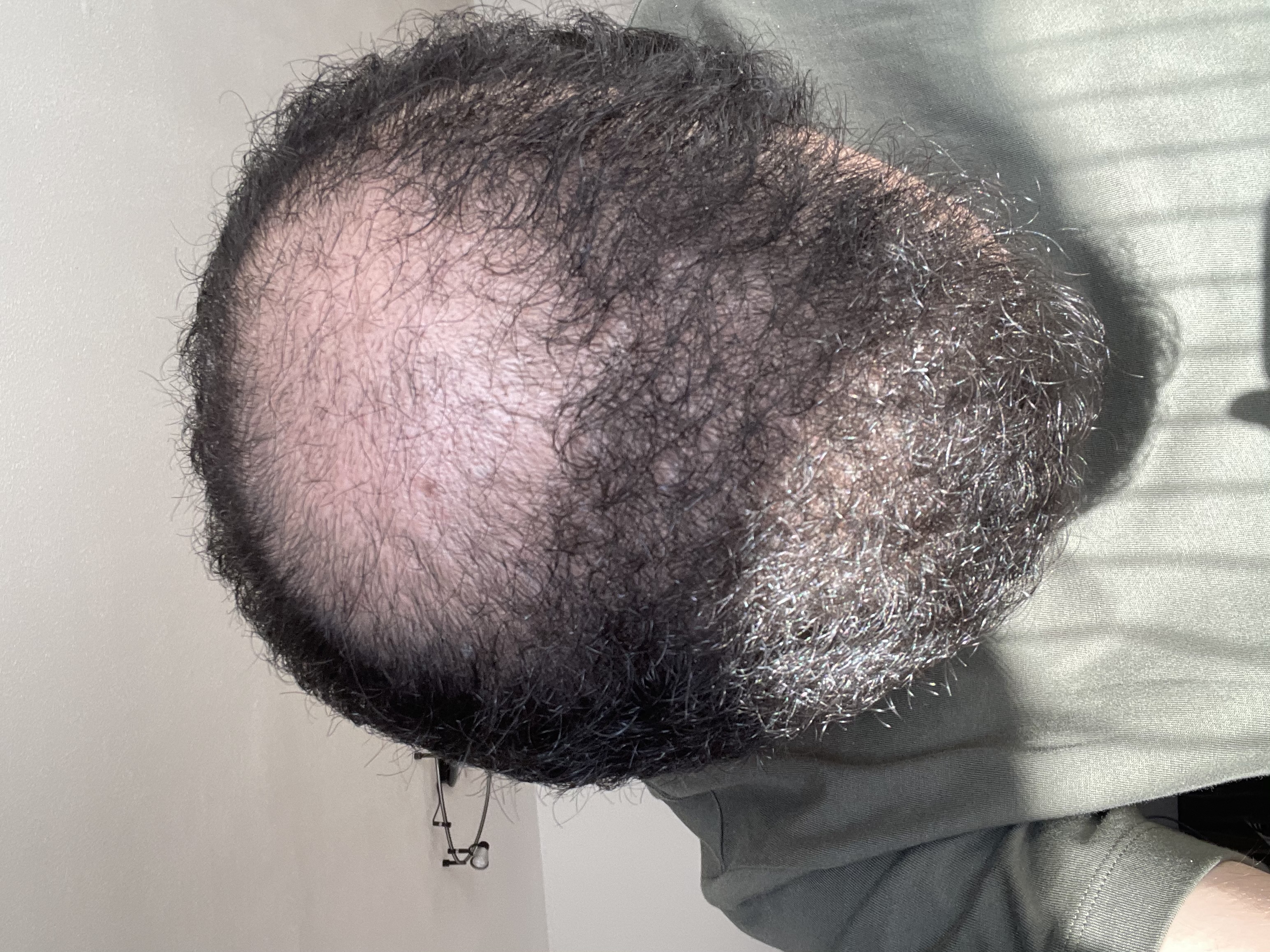 /foren/transplant/index.php/fa/52553/0/