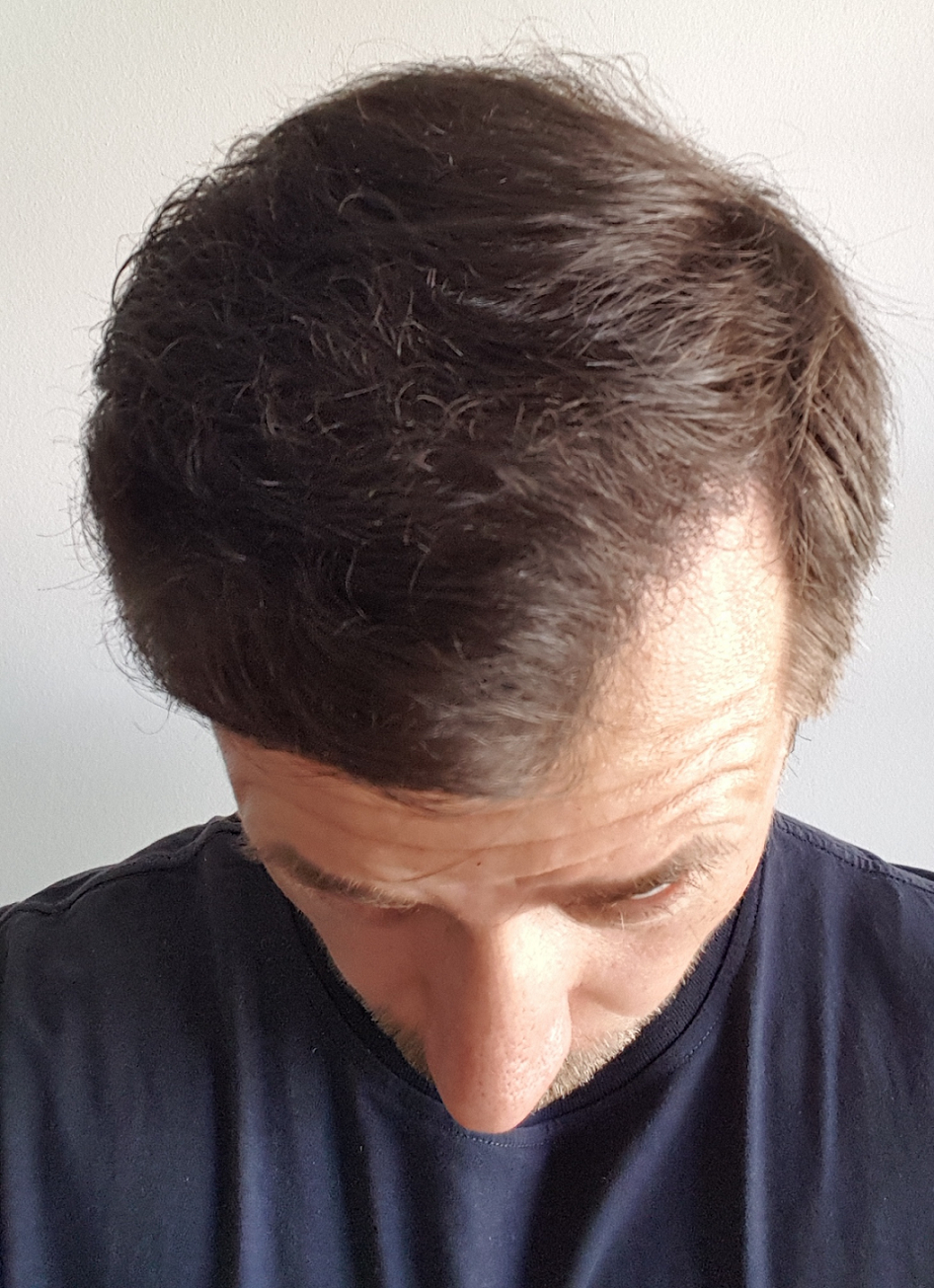 /foren/transplant/index.php/fa/52655/0/