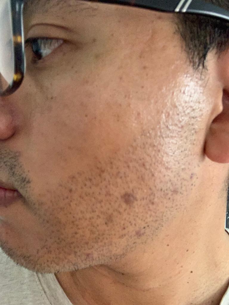 /foren/transplant/index.php/fa/52666/0/