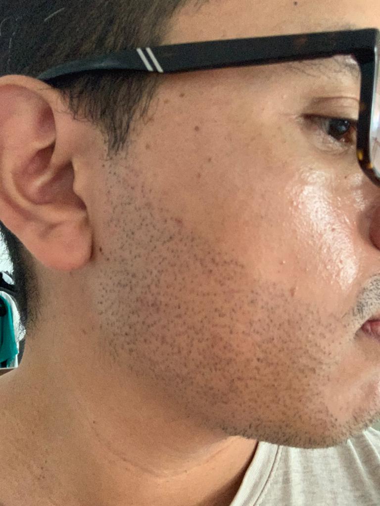 /foren/transplant/index.php/fa/52667/0/