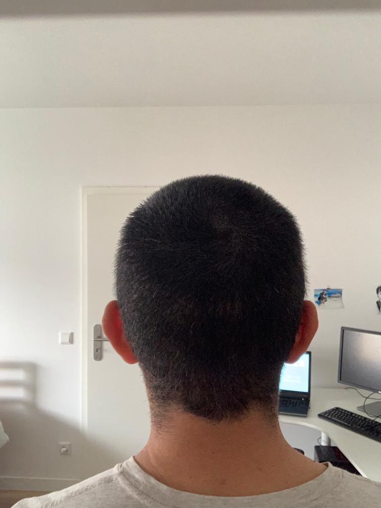 /foren/transplant/index.php/fa/52668/0/