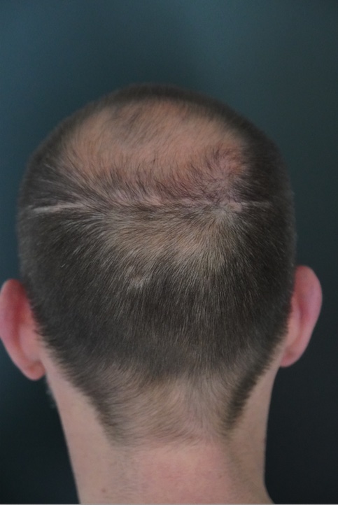 /foren/transplant/index.php/fa/52671/0/