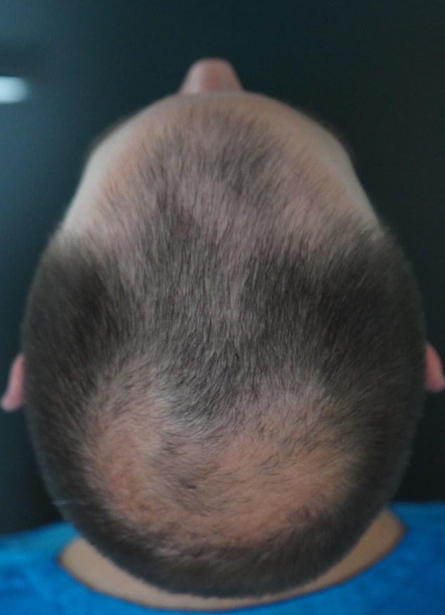 /foren/transplant/index.php/fa/52672/0/