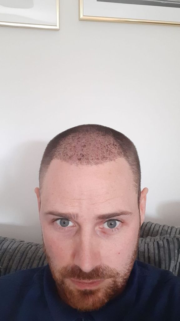 /foren/transplant/index.php/fa/52702/0/