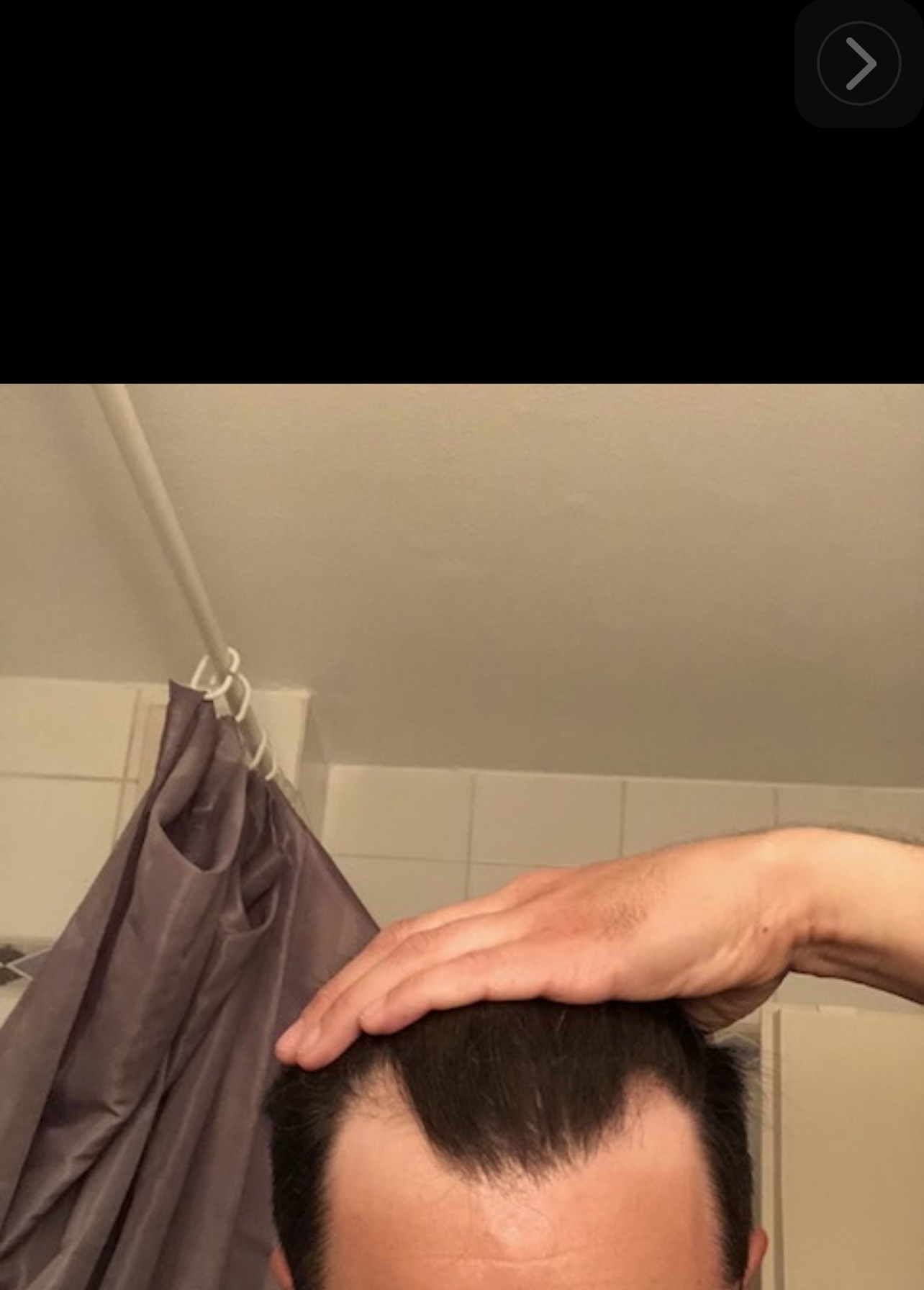 /foren/transplant/index.php/fa/52748/0/