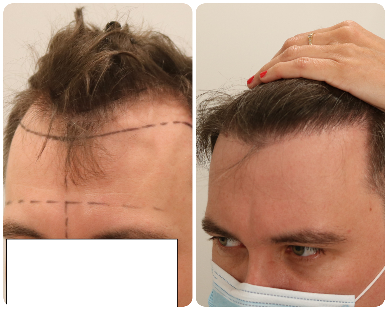 /foren/transplant/index.php/fa/52880/0/