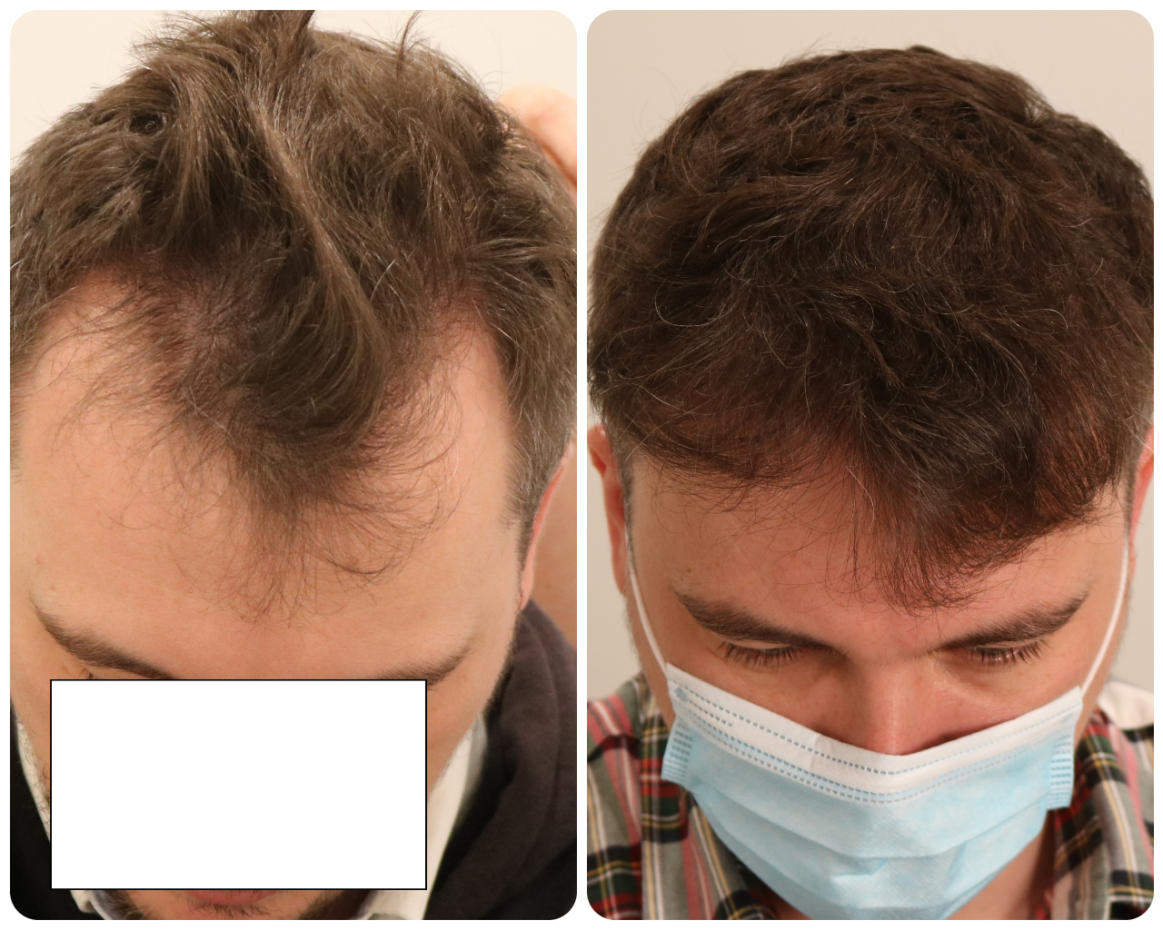 /foren/transplant/index.php/fa/52881/0/