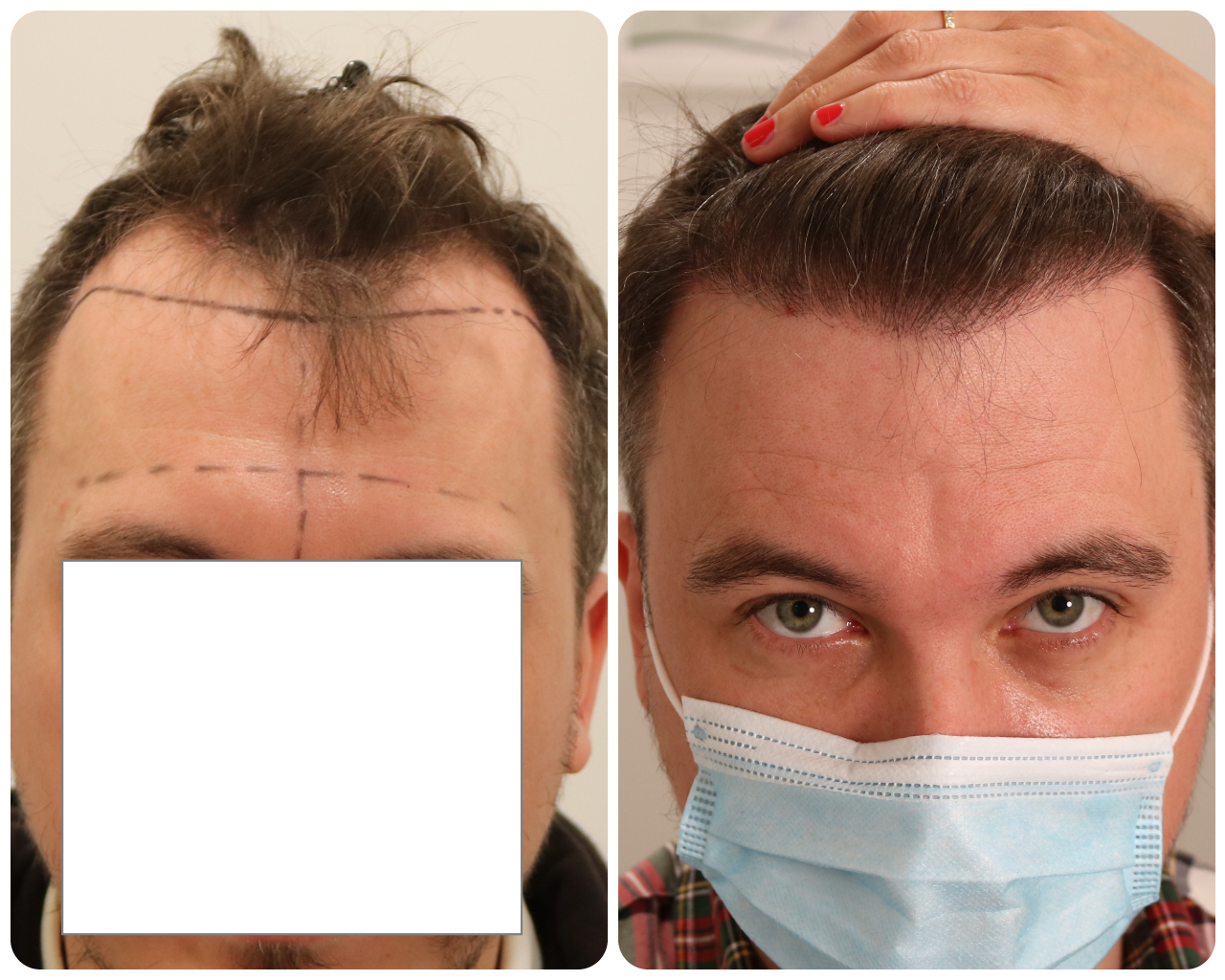 /foren/transplant/index.php/fa/52882/0/