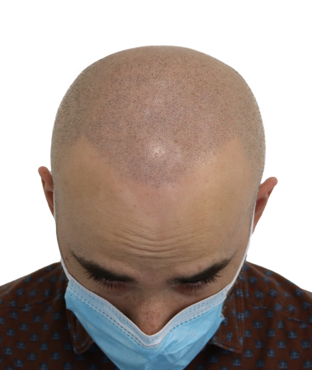 /foren/transplant/index.php/fa/52900/0/