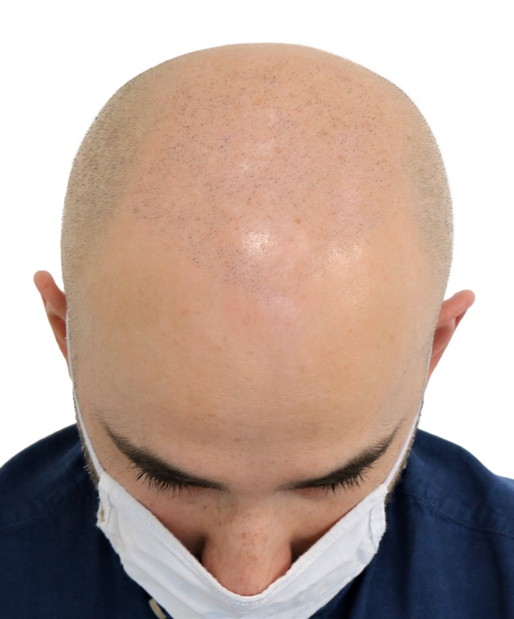 /foren/transplant/index.php/fa/52901/0/