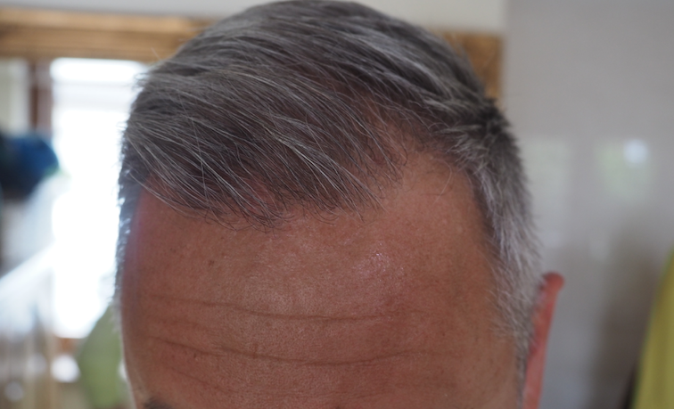 /foren/transplant/index.php/fa/52905/0/