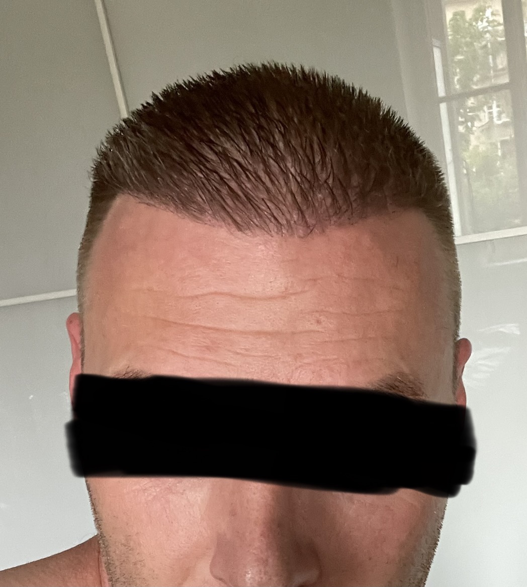 /foren/transplant/index.php/fa/52936/0/